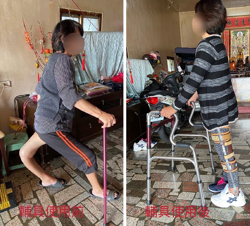 輔具適配更方便 助行動不便者找回行動力 不只用拐杖! 穿輔具改善嚴重變形下肢 「專業評估」更適配